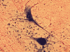 Нейроны 400x268 113kb